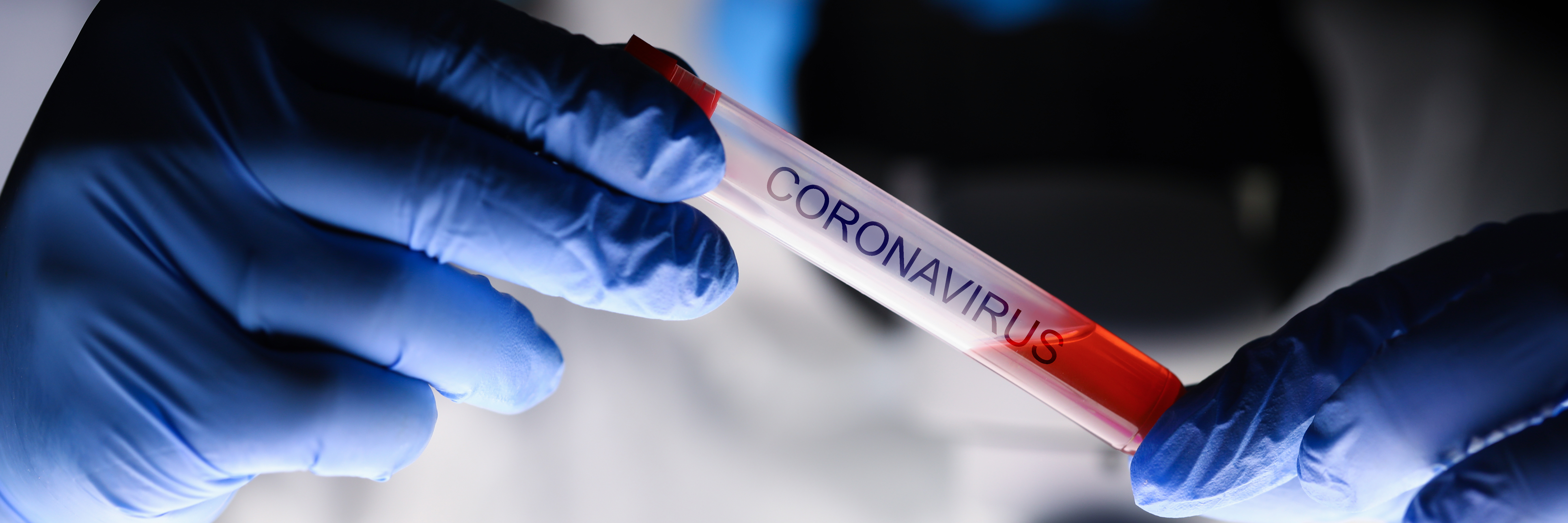 Tubo de ensayo Coronavirus